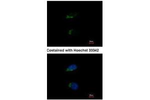 ICC/IF Image Immunofluorescence analysis of methanol-fixed HeLa, using JIK, antibody at 1:500 dilution. (TAO Kinase 3 antibody)