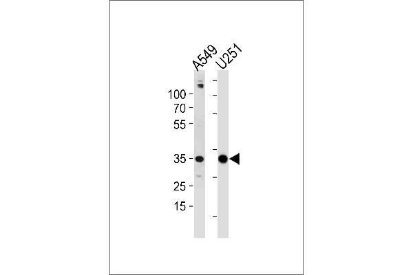 ASB9 antibody  (N-Term)
