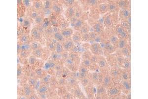 IHC-P analysis of liver tissue, with DAB staining. (Fibrosin antibody  (AA 11-247))
