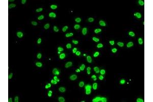 Immunofluorescence (IF) image for anti-Actin-Like 6B (ACTL6B) (AA 1-280) antibody (ABIN6136481)