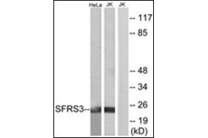Western blot analysis of extracts from HeLa/Jurkat cells, using SFRS3 Antibody.