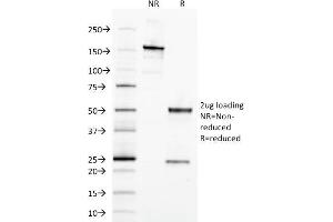 SDS-PAGE (SDS) image for anti-Epithelial Cell Adhesion Molecule (EPCAM) (AA 77-202), (Extracellular Domain) antibody (ABIN6939980)