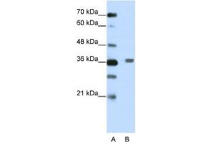 WB Suggested Anti-BTBD6 Antibody Titration:  2. (BTBD6 antibody  (N-Term))