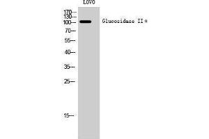 Western Blotting (WB) image for anti-Glucosidase, Alpha, Neutral AB (GANAB) (Internal Region) antibody (ABIN3184803)