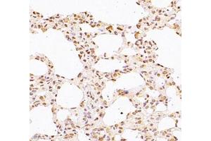 Immunohistochemistry of paraffin embedded rat lung using WDR13 (ABIN7076212) at dilution of 1: 2500 (400x lens) (WDR13 antibody)