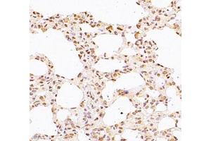 Immunohistochemistry of paraffin embedded rat lung using WDR13 (ABIN7076212) at dilution of 1: 2500 (400x lens) (WDR13 antibody)