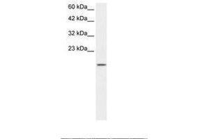 Image no. 1 for anti-Zinc Finger Protein 7 (ZNF7) (AA 62-111) antibody (ABIN202870)