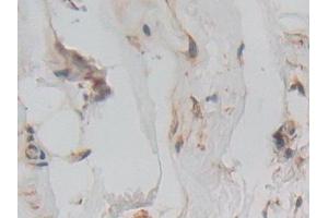 Immunohistochemistry (IHC) image for anti-Interferon alpha (IFNA) (AA 28-227) antibody (ABIN7437731)