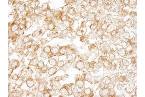 Immunohistochemistry (IHC) image for anti-Epidermal Growth Factor Receptor Pathway Substrate 15 (EPS15) (AA 575-625) antibody (ABIN7448961)