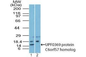 Image no. 1 for anti-Chromosome 6 Open Reading Frame 57 (C6ORF57) (AA 75-104) antibody (ABIN960066) (C6ORF57 antibody  (AA 75-104))