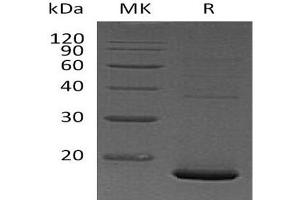 Western Blotting (WB) image for Pleiotrophin (PTN) protein (His tag) (ABIN7320789) (Pleiotrophin Protein (PTN) (His tag))