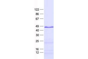 Validation with Western Blot