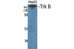 Western Blot (WB) analysis of specific cells using Trk B Polyclonal Antibody. (TRKB antibody  (Thr184))