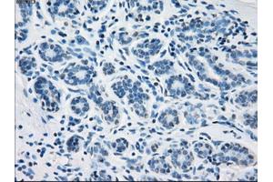 Immunohistochemical staining of paraffin-embedded breast tissue using anti-FH mouse monoclonal antibody. (FH antibody)