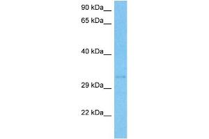 Western Blotting (WB) image for anti-Annexin A4 (ANXA4) (N-Term) antibody (ABIN2774909)