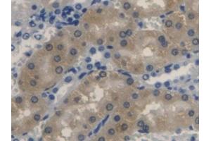 Detection of BLVRA in Rat Kidney Tissue using Polyclonal Antibody to Biliverdin Reductase A (BLVRA) (Biliverdin Reductase antibody  (AA 10-279))