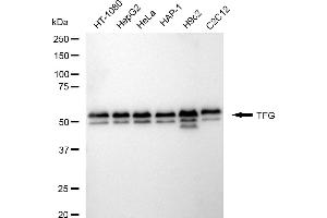 Western blotting analysis using TFG antibody (ABIN7800647).