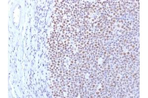 Formalin-fixed, paraffin-embedded human Tonsil stained with DNMT1 Mouse Monoclonal Antibody (DNMT1/2061). (DNMT1 antibody  (AA 767-912))