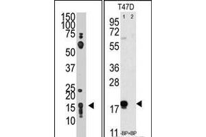 Image no. 1 for anti-CD90 (THY1) (N-Term) antibody (ABIN357443) (CD90 antibody  (N-Term))