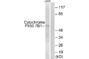Western blot analysis of extracts from LOVO cells, using Cytochrome P450 7B1 antibody. (CYP7B1 antibody)