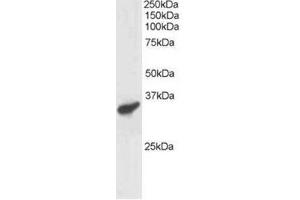 Image no. 1 for anti-Polycomb Group Ring Finger 3 (PCGF3) (C-Term) antibody (ABIN374301) (PCGF3 antibody  (C-Term))