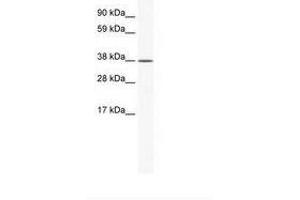 Image no. 1 for anti-Kruppel-Like Factor 2 (Lung) (KLF2) (AA 182-231) antibody (ABIN202326) (KLF2 antibody  (AA 182-231))