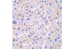 Immunohistochemistry of paraffin-embedded human liver injury using EHHADH antibody (ABIN6292474) at dilution of 1:100 (40x lens).