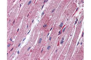 Anti-MYL9 antibody IHC of human heart. (MYL9 antibody  (C-Term))