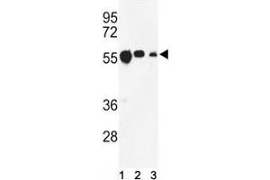 Western blot analysis of anti-beta Tubulin antibody and (1) CEM, (2) MCF-7, and (3) MDA-MB231 lysate. (TUBB1 antibody)