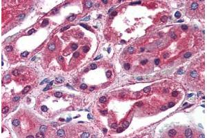 Kidney: Formalin-Fixed, Paraffin-Embedded (FFPE) (SCNN1G antibody  (C-Term))
