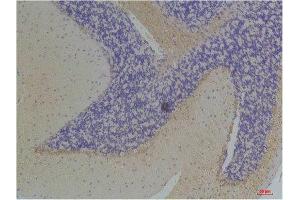 Immunohistochemistry (IHC) analysis of paraffin-embedded Mouse Brain Tissue using KChIP3 Rabbit Polyclonal Antibody diluted at 1:200. (DREAM antibody)