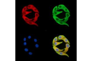 ABIN7096163 and ABIN7100225 staining Hela cells by IF/ICC.