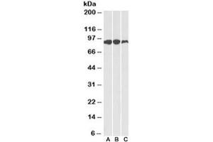 Western blot of human (A), mouse (B) and rat (C) adipose lysates with Aconitase 2 antibody at 0. (ACO2 antibody)