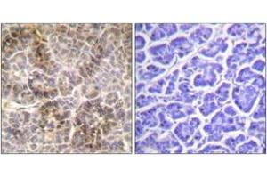 Immunohistochemistry analysis of paraffin-embedded human pancreas, using Moesin/Ezrin/Radixin (Phospho-Thr558) Antibody. (Moesin/ezrin/radixin (AA 524-573), (pThr558) antibody)