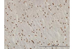 Immunoperoxidase of monoclonal antibody to ZNF313 on formalin-fixed paraffin-embedded human lateral ventricle wall. (RNF114 antibody  (AA 1-228))