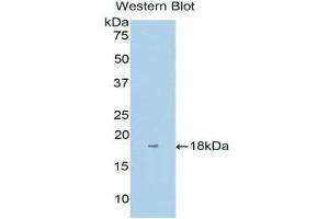 Western Blotting (WB) image for anti-Interleukin 1 Receptor Accessory Protein (IL1RAP) (AA 420-558) antibody (ABIN1859395) (IL1RAP antibody  (AA 420-558))