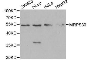 Western blot analysis of extracts of various cell lines, using MRPS30 antibody. (MRPS30 antibody  (AA 190-439))