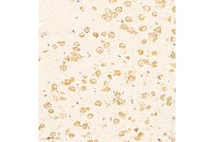Immunohistochemistry of paraffin embedded mouse brain using SCN4b (ABIN7075646) at dilution of 1:2000 (300x lens) (SCN4B antibody)