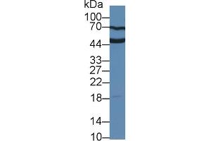 Detection of UPK3A in Human Serum using Polyclonal Antibody to Uroplakin 3A (UPK3A) (Uroplakin 3A antibody  (AA 15-211))