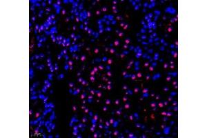 Immunofluorescence of paraffin embedded mouse kidney using PABPN1 (ABIN7075116) at dilution of 1:600 (400x lens) (PABPN1 antibody)
