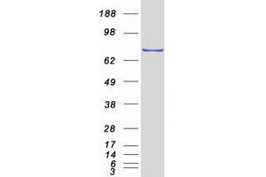 Validation with Western Blot (TCF25 Protein (Myc-DYKDDDDK Tag))
