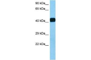 Western Blotting (WB) image for anti-Homeodomain Interacting Protein Kinase 2 (HIPK2) (Middle Region) antibody (ABIN2779735)