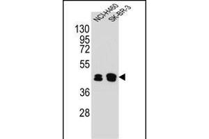 KRT80 Antibody (C-term) (ABIN654828 and ABIN2844502) western blot analysis in NCI-,SK-BR-3 cell line lysates (35 μg/lane).