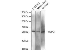 Western blot analysis of extracts of various cell lines, using PDI antibody (ABIN6128422, ABIN6145387, ABIN6145388 and ABIN6216541) at 1:3000 dilution. (PDIA2 antibody  (AA 326-525))