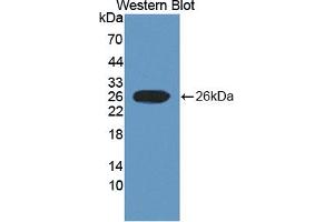 Figure. (SCUBE3 antibody  (AA 807-993))