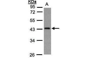 WB Image Sample(30 ug whole cell lysate) A:Hep G2 , 10% SDS PAGE antibody diluted at 1:1000 (GNaZ antibody  (Center))