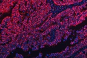 IF analysis of TRMT10C using anti-TRMT10C antibody (ABIN7601472).
