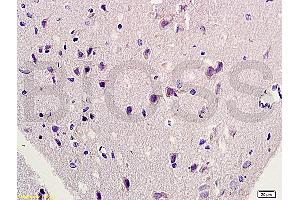 Formalin-fixed and paraffin embedded rat brain labeled with Rabbit Anti-HSP27/HspB1/HSP25 Polyclonal Antibody, Unconjugated (ABIN672441) at 1:200 followed by conjugation to the secondary antibody and DAB staining.