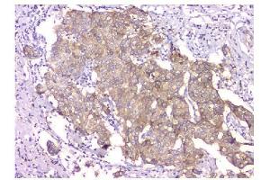 IHC analysis of WWOX using anti-WWOX antibody (ABIN6719627). (WWOX antibody  (AA 1-245))