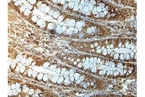 Immunohistochemistry (IHC) image for anti-Makorin Ring Finger Protein 3 (MKRN3) antibody (ABIN1855943) (MKRN3 antibody)
